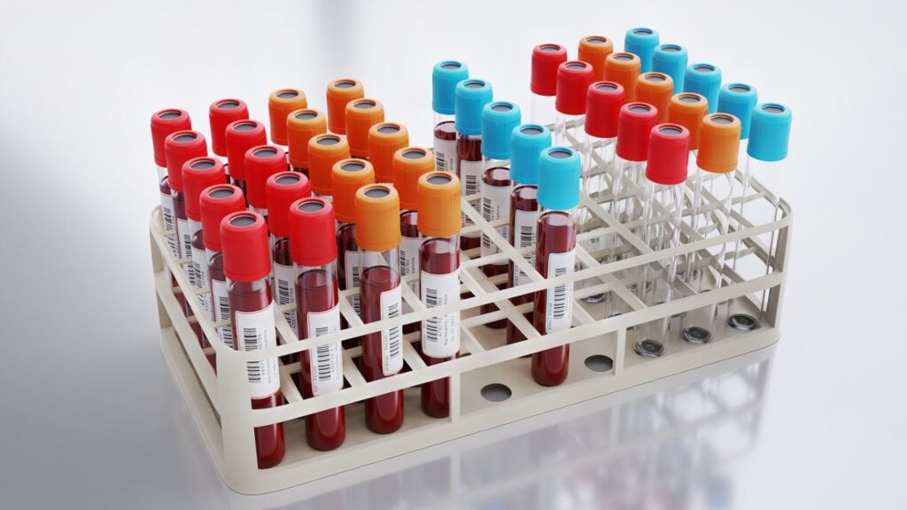 P24 Antijen Testi Nedir ve Nasıl Yapılır? 1 P24 Antijen Testi Nedir ve Nasıl Yapılır?