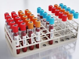 P24 Antijen Testi Nedir ve Nasıl Yapılır?